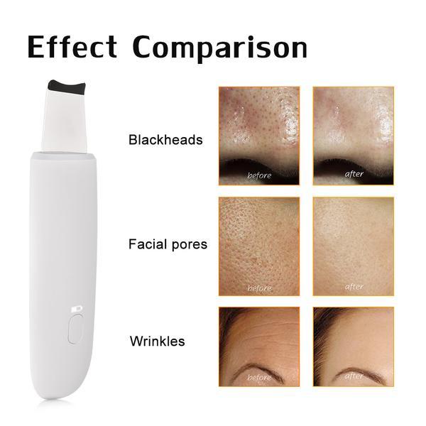The Ultimate Face Cleaner My Store