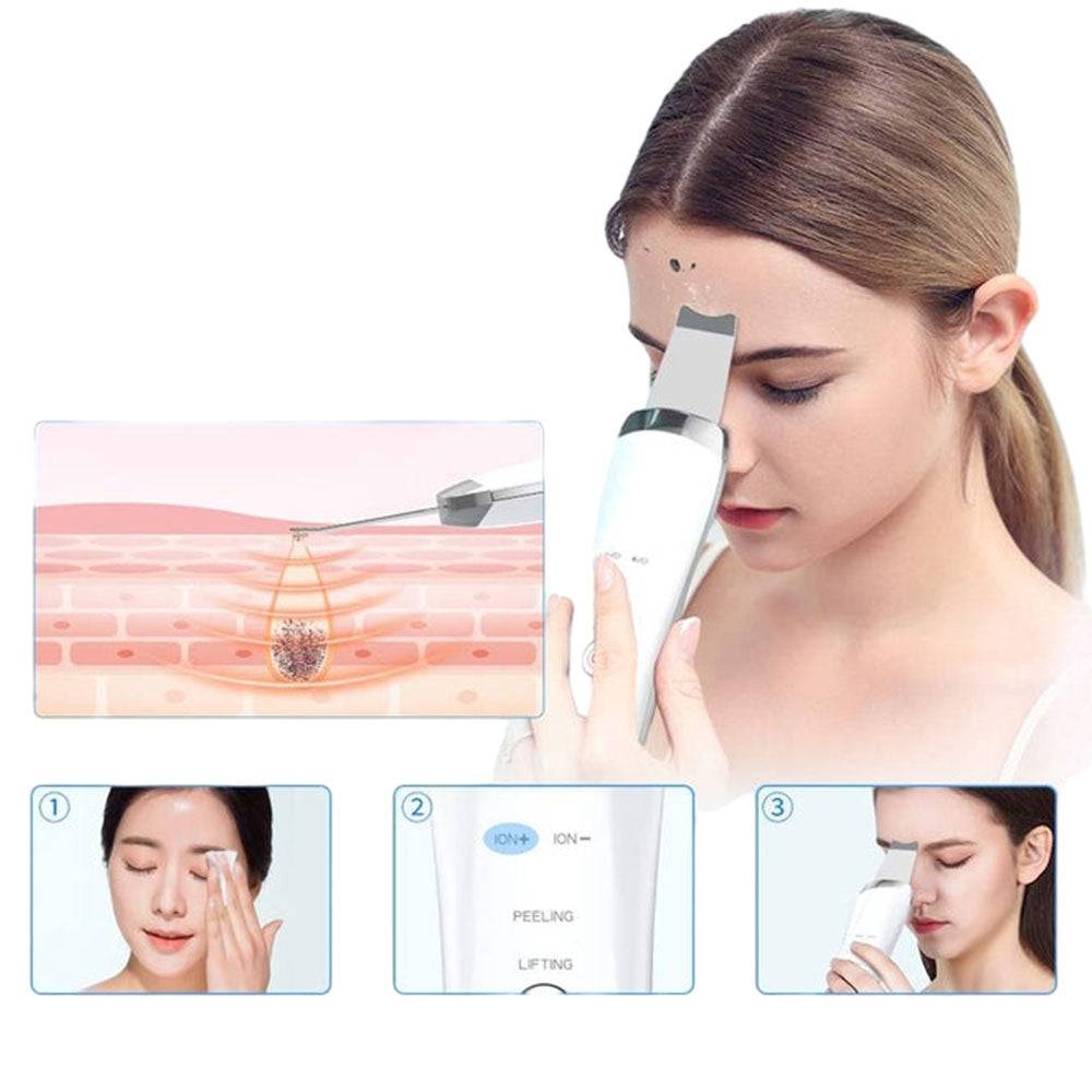 Electric Ultrasonic Skin Scrubber Face Spatula Home Ultrasonic Skin Scrubber Facial Cleaner Handheld Mini Derma Galvanica Tightening Face Scrubber Machine Skin Scrubber USB Ultrasonic My Store